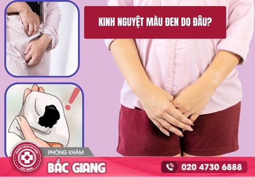 kinh nguyệt màu đen