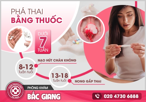 đình chỉ thai
