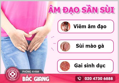 âm đạo sần sùi