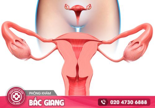 chảy máu cổ tủ cung