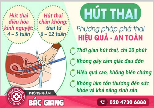 Hút thai có lâu không? Tìm hiểu quy trình hút thai
