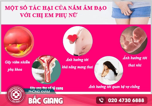 Cách trị nấm Candida tại nhà có nên hay không?
