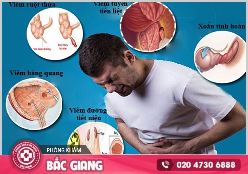 Đau bụng dưới ở bên trái và các vấn đề liên quan