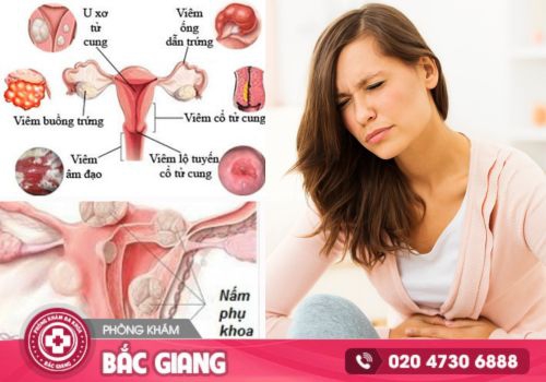 Đau bụng dưới ở bên trái và các vấn đề liên quan
