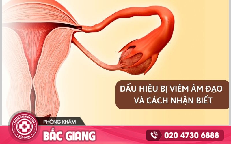 dấu hiệu bị viêm âm đạo
