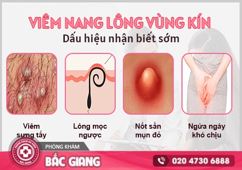 viêm nang lông vùng kín nữ