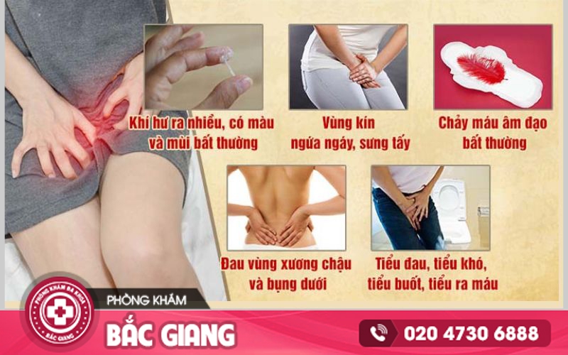 viêm âm đạo mãn tính