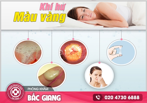 ngứa vùng kín và ra dịch màu vàng
