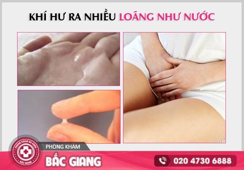 khí hư ra nhiều loãng như nước