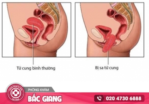 sa sinh dục