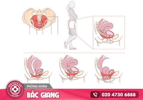 sa sinh dục