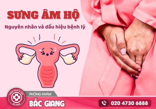 sưng âm hộ
