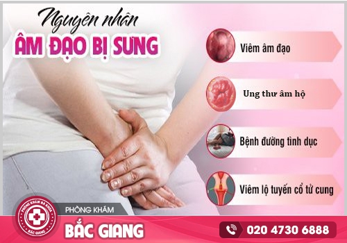 Sưng âm đạo là bệnh gì? Có nguy hiểm không?