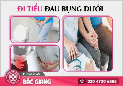 Đi tiểu đau bụng dưới những điều bạn cần lưu ý