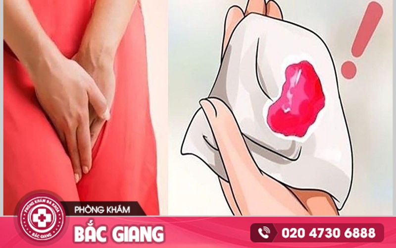 viêm âm đạo chảy máu