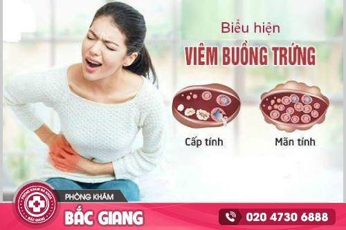 Tìm hiểu về bệnh viêm buồng trứng và hướng điều trị hiệu quả