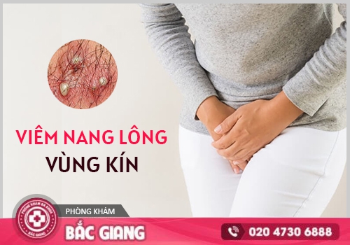viêm nang lông vùng kín nữ
