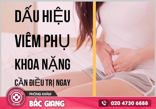 5 dấu hiệu điển hình của viêm phụ khoa nặng - Cách nhận biết để điều trị kịp thời